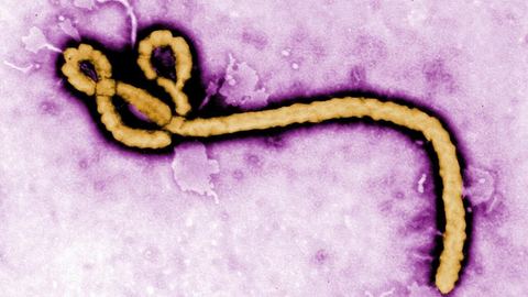 Ebola en France : mesures strictes pour limiter la propagation
